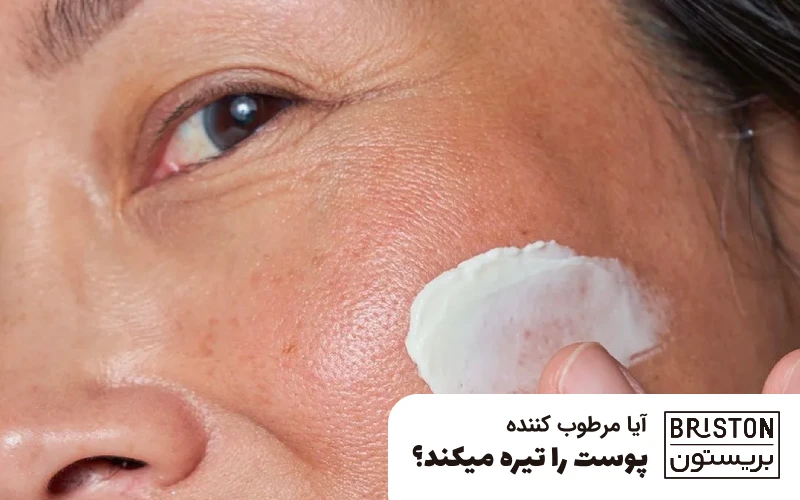 آیا کرم مرطوب کننده پوست را تیره میکند؟