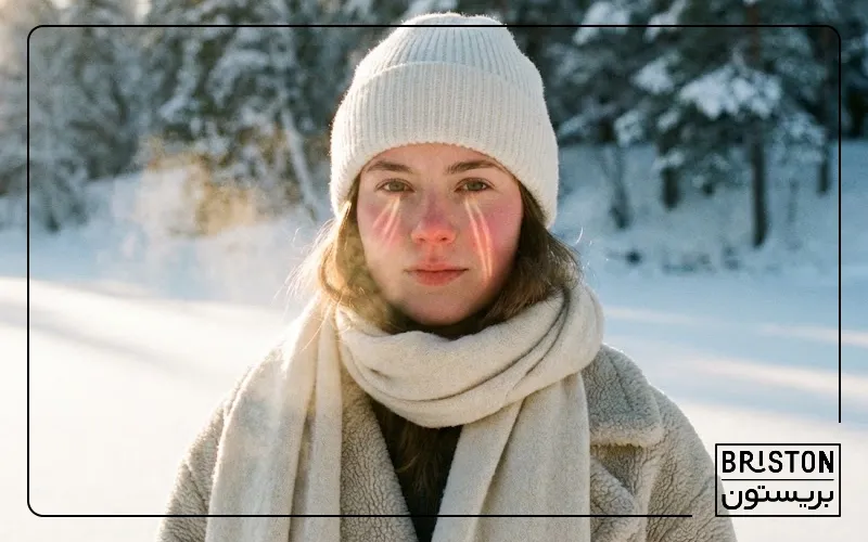 چرا در زمستان باید ضد آفتاب بزنیم؟ راهنمای کامل محافظت پوست در هوای سرد